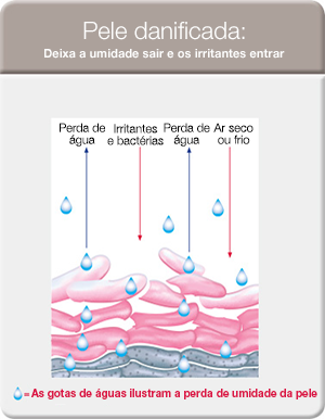 hollister-image-illustrating-damaged-skin